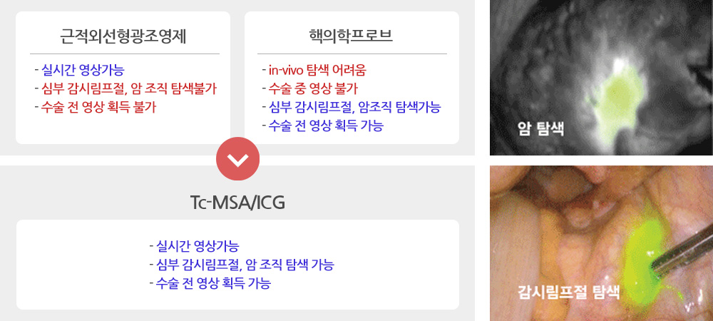 Tc-MSA/ICG